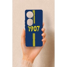 Vip Case Vivo V40 Uyumlu 1907 Kemer Desenli Silikon Kılıf