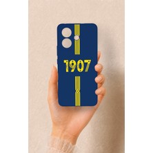 Vip Case Vivo V60 Lite Uyumlu 1907 Kemer Desenli Silikon Kılıf