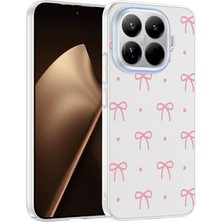 Roketcim Xiaomi 15T Pro Kılıf Kamera Korumalı Desenli Klip Kapak