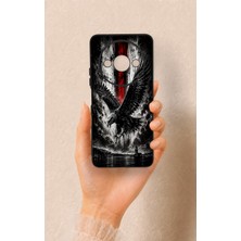 Vip Case Redmi A3 Uyumlu Kara Kartal Desenli Silikon Kılıf