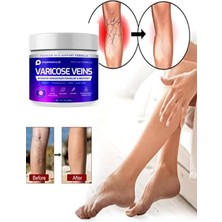 Aydogan's Maximum Strength Varicose Vein Var.is Bacak Bakım Masaj Kremi 100 ml 2 Adet