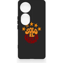 Vip Case Vivo V40 Uyumlu Solo Il Gala Desenli Silikon Kılıf