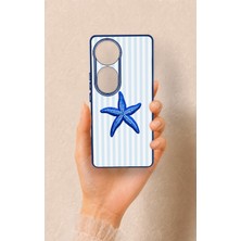 Vip Case Vivo V40 Uyumlu Mavi Deniz Yıldızı Desenli Silikon Kılıf