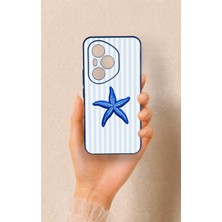Vip Case Honor 400 Pro Uyumlu Mavi Deniz Yıldızı Desenli Silikon Kılıf