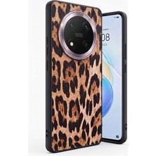 Anka Cep Cep Telefonu Aksesuarları Honor Magic 7 Lite Kılıf Leopar Desenli Lüks Tasarım Esnek ve Dayanıklı Arka Kapak
