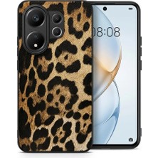 Anka Cep Cep Telefonu Aksesuarları Vivo X200 Fe Kılıf Leopar Desenli Lüks Tasarım Esnek ve Dayanıklı Arka Kapak