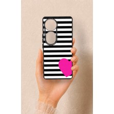 Vip Case Vivo V40 Uyumlu Çizgili Kalp Desenli Silikon Kılıf