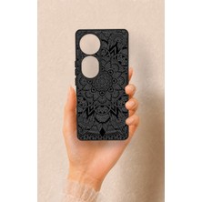 Vip Case Vivo V40 Uyumlu Siyah Beyaz Mandala Desenli Silikon Kılıf