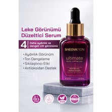 SHEOVATION Leke Serumu | Traneksamik Asit, Arbutin, Niacinamide ve C Vitamini İçeren Ton Eşitleyici Aydınlatıcı Bakım Serumu 30 ml