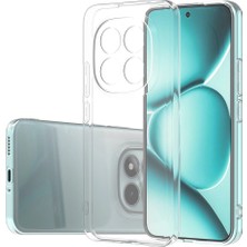 Miscase Redmi Note 15 4g Sert Şeffaf Telefon Kılıfı