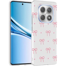 StilStoreTr Xiaomi Redmi Note 15 5g Kılıf Çiçek ve Fiyonk Desenli Kamera Yükseltili Stsr Premium