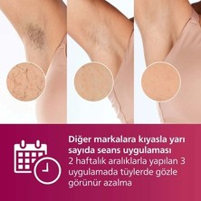Sungur's Store Ipl Tüy Alma Cihazı - Vücut ve Yüz Için 2 Başlık ile