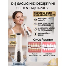 Alpkan Ce-Dent Aquapulse Taşınabilir Şarjlı Ağız Duşu 300 ml - 4 Kademeli Diş Temizleme Cihazı, Diş Teli ve Implant Uyumlu Plak Tartar Temizleyici Su Püskürtücü + 4 Başlık Ağız Duşu Beyaz