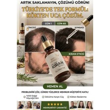 Bio Köyceğiz'den Sofranıza SAÇ KIRAN, SAKAL KIRAN, KAŞ, Alopecia areata Serum 50ML Dökülme Karşıtı Besleyici Etki ( Erkek - Kadın )