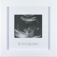 Neva Home Ilk Fotoğrafım Bebek Ultrason Çerçevesi - Bebek Odası Resim Anı Çerçevesi