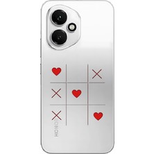 LOTUS GOLD Honor 400 Uyumlu Kalp Desenli Şeffaf Telefon Kılıfı
