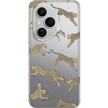 LOTUS GOLD Honor 400 Pro 5g Uyumlu Leopar Desenli Şeffaf Telefon Kılıfı