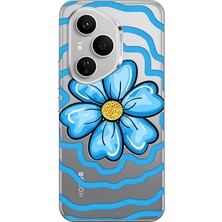 LOTUS GOLD Honor 400 Pro 5g Uyumlu Çiçek Desenli Şeffaf Telefon Kılıfı