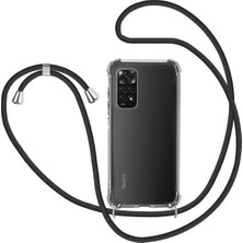 Emybox Xiaomi Redmi Note 11 / Note 11S Boyun Askılı Köşe Korumalı Şeffaf Silikon Telefon Kılıfı