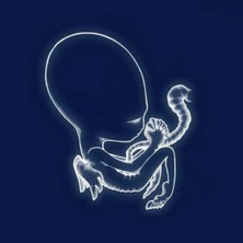 B Side Club Sigur Rós - Ágætis Byrjun