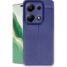 Sh Ticaret 13 Pro 4g Auto Focus Kapak - Lacivert