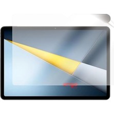 Trendexa Xiaomi Poco Pad X1 11.2 Inç Paperfeel Ekran Koruyucu; Mat Kağıt Hissi, Tablet Kalemi, Not Alma ve Çizim Için