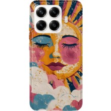 MONOFLEX Xiaomi 17T Pro Uyumlu Pastel Yağlı Boya Güneş Yüzü Desenli Şeffaf Telefon Kılıfı