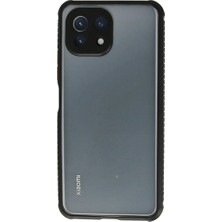 Xiaomi Mi 11 Lite Kılıf Miami Şeffaf Silikon - Siyah