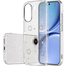 Khi-Zai Xiaomi Poco X8 Pro Fiyonk Desenli Kapak - Desen 2