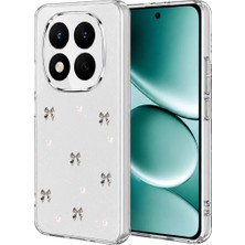 Renklime Newface Xiaomi Redmi Note 15 Pro Plus 5g Fiyonk Desenli Kapak - Desen 8