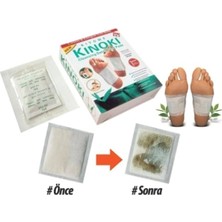 Pileli Store Detox Ayak Bandı (10 Adet)
