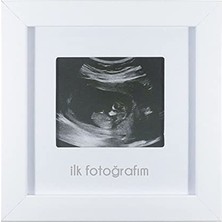 aklow akyoleticaret Ilk Fotoğrafım Bebek Ultrason Çerçevesi, Bebek Odası Anı Çerçevesi