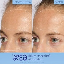 Şanal Koyu Lekeleri Aydınlatan Serum 50 ml