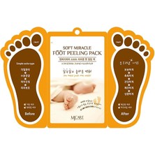 MSP Miracle Çorap Tipi Ayak Peeling Maskesi