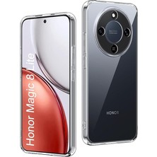 MSP Honor Magic 8 Lite ile Uyumlu Kılıf, 2mm Kalınlaştırılmış Şeffaf Silikon, Darbe Emici Kamera Korumalı Esnek Arka Kapak