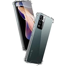 Trendexa Xiaomi Redmi Note 11 Pro ile Uyumlu ile Uyumlu Kapak Şeffaf Airbag Antishock Köşe Korumalı Silikon Kılıf