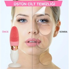 MiraLive Derin Gözenek Temizliği Için Ince Kaba Silikon Uçlu Elektrikli Yüz Temizleme Fırçası