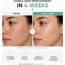 Store Azelaik Asit Serumu Niacinamide & Çinko ile 30ML