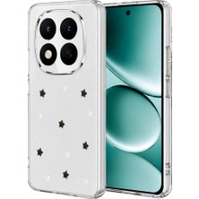 Zenviaa Mey Ithalat®  Redmi Note 15 Pro 5g Fiyonk Desenli Kapak - Desen 7 ZNV20296545