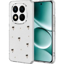 Zenviaa Mey Ithalat®  Redmi Note 15 Pro Plus 5g Fiyonk Desenli Kapak - Desen 1 ZNV20296545