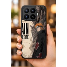 BG AKSESUAR Xiaomi Mi 17T Pro Uyumlu Pain Desenli Kamera Korumalı Darbelere Dayanıklı Kılıf