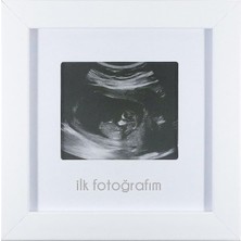 Ilk Fotoğrafım Bebek Ultrason Çerçevesi - Bebek Odası Resim Anı Çerçevesi