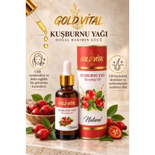 Kuşburnu Yağı 20 ml – Rosehip Oil – Doğal Cilt Bakım Yağı