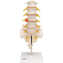 Pratik Ev A76/5 Bel Omurga Sütunu, Dorso-Lateral Prolapsed Intervertebral Disk, 34 cm Yükseklik