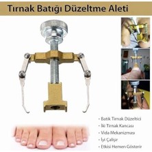 Batık Tırnak Düzeltme Aleti - Vida Mekanizması ve Iki Tırnak Kancasıyla Etkili Batık Tırnak Tedavisi - Hızlı Sonuç ve Kolay Kullanım | BT19