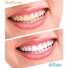 Munico 2 Adet LED Işıklı Diş Parlatıcı, Beyazlatıcı, Leke Çıkarıcı Luma Smile Kauçuk Kaplar Diş Beyazlatma
