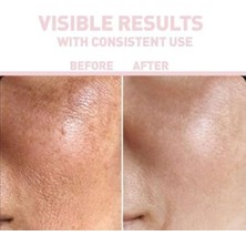 Prime Nıacınamıde%10 + Hyaluronıc Acıd%2 Serum