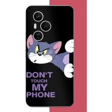 Aksesuarist Honor 400 Pro Uyumlu Telefonuma Dokunma2 Baskılı Silikon Kılıf