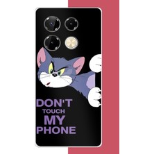 Aksesuarist Infinix Note 40 Pro Uyumlu Telefonuma Dokunma2 Baskılı Silikon Kılıf