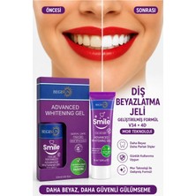 Hysmile Begisun Smile Mor Ton Diş Bakım Jeli 50 ml – V34 & 4D Destekli